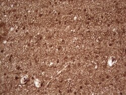 NF-M Antibody (OTI2G3), Novus Biologicals 0.1mL; Unlabeled:Antibodies,