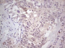 NF-M Antibody (OTI2G3), Novus Biologicals 0.1mL; Unlabeled:Antibodies,