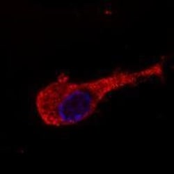 NF-M Antibody (NF-09) - BSA Free 0.1mg; Unlabeled:Antibodies, Monoclonal
