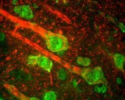 NF-M Antibody, Novus Biologicals 0.1mL; Unlabeled:Antibodies, Polyclonal