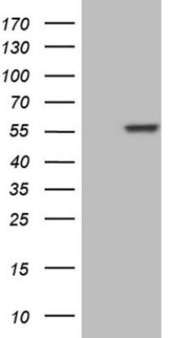 NFS1 Antibody (OTI2H5), Novus Biologicals 0.1mL; Unlabeled:Antibodies,