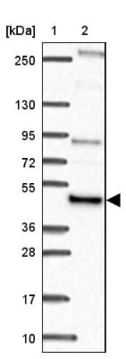 NFS1 Antibody, Novus Biologicals 0.1mL; Unlabeled:Antibodies, Polyclonal