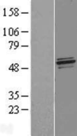 Novus Biologicals&trade;&nbsp;NFS1 Overexpression Lysate