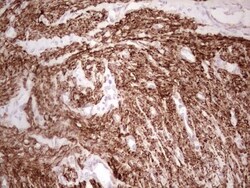 NFS1 Antibody (OTI2H5), Novus Biologicals 0.1mL; Unlabeled:Antibodies,