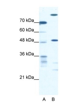 NFS1 Antibody, Novus Biologicals 0.1mg; Unlabeled:Antibodies, Polyclonal