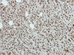NFYB Antibody, Novus Biologicals 0.1 mL | Buy Online | Novus Biologicals | Fisher Scientific