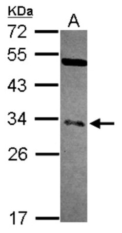 NFYB Antibody, Novus Biologicals 0.1 mL | Buy Online | Novus Biologicals | Fisher Scientific