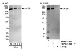 NG2/MCSP Antibody, Novus Biologicals 0.1mL; Unlabeled:Antibodies, Polyclonal