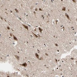 NGEF Antibody, Novus Biologicals:Antibodies:Primary Antibodies