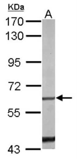 NGFI-B alpha/Nur77/NR4A1 Antibody, Novus Biologicals 0.1 mL | Buy Online | Novus Biologicals | Fisher Scientific