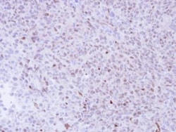 NGFRAP1/BEX3/NADE Antibody, Novus Biologicals 0.1mL; Unlabeled:Antibodies,