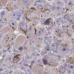 NGL-3/LRRC4B/LRCH4B Antibody, Novus Biologicals 25 &mu;L, Unlabeled:Antibodies,