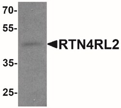 NgR2/NgRH1/RTN4RL2 Antibody - BSA Free, Novus Biologicals:Antibodies:Primary
