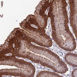 NgR3/NgRH2/RTN4RL1 Antibody, Novus Biologicals:Antibodies:Primary Antibodies