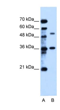 NGX6 Antibody, Novus Biologicals 100&mu;L; Unlabeled:Antibodies, Polyclonal