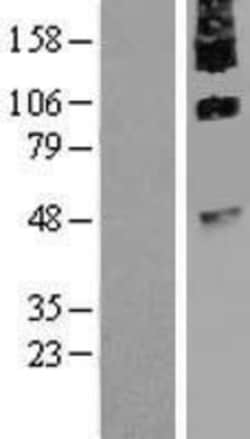Novus Biologicals&trade;&nbsp;NGX6 Overexpression Lysate