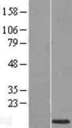 Novus Biologicals&trade;&nbsp;NHC Overexpression Lysate