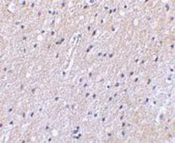 NHE1/SLC9A1 Antibody - BSA Free, Novus Biologicals 0.1mg; Unlabeled:Antibodies,