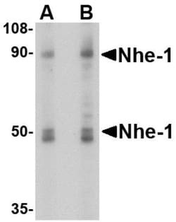 NHE1/SLC9A1 Antibody - BSA Free, Novus Biologicals 0.1mg; Unlabeled:Antibodies,