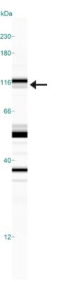 NHE3/SLC9A3, p Ser552 Antibody (14D5), Novus Biologicals 0.1mL; Unlabeled:Antibodies,