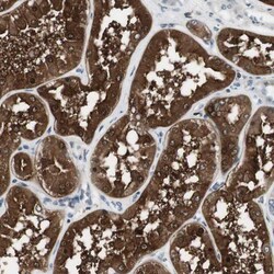 NHERF-1 Antibody, Novus Biologicals:Antibodies:Primary Antibodies