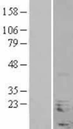 Novus Biologicals&trade;&nbsp;NHLH1 Overexpression Lysate