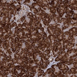 NHLRC2 Antibody, Novus Biologicals:Antibodies:Primary Antibodies