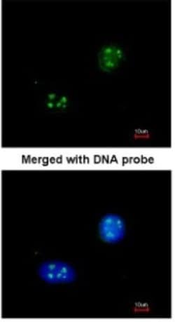 NHP2L1 Antibody, Novus Biologicals 100 ul; Unconjugated:Antibodies, Polyclonal