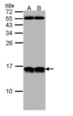 NHP2L1 Antibody, Novus Biologicals 100 ul; Unconjugated:Antibodies, Polyclonal