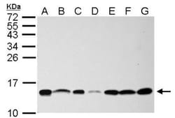 NHP2L1 Antibody, Novus Biologicals 100 ul; Unconjugated:Antibodies, Polyclonal