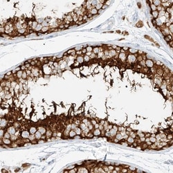 NHSL1 Antibody, Novus Biologicals:Antibodies:Primary Antibodies