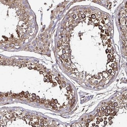 Nicastrin Antibody, Novus Biologicals 25 &mu;L, Unlabeled:Antibodies, Polyclonal
