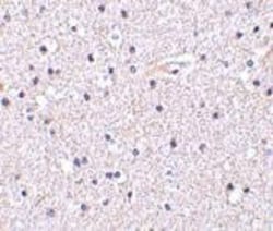 Nicastrin Antibody - BSA Free, Novus Biologicals 0.1mg; Unlabeled:Antibodies,