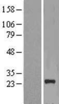 Novus Biologicals&trade;&nbsp;NICN1 Overexpression Lysate