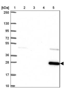 Nicotinamide N-Methyltransferase/NNMT Antibody, Novus Biologicals 0.1mL;