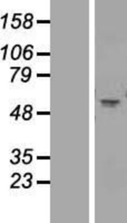 Novus Biologicals&trade;&nbsp;Nicotinic Acetylcholine R alpha 1/CHRNA1 Overexpression Lysate