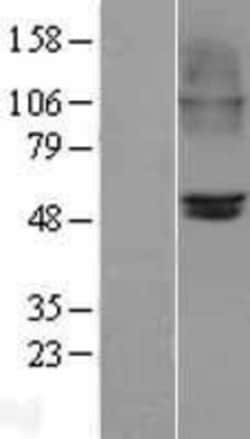 Novus Biologicals&trade;&nbsp;Nicotinic Acetylcholine Receptor beta 2 Overexpression Lysate