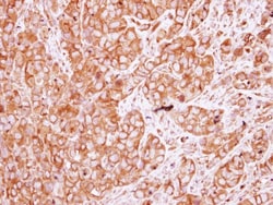 Nicotinic Acetylcholine Receptor beta Antibody, Novus Biologicals 0.1mL;