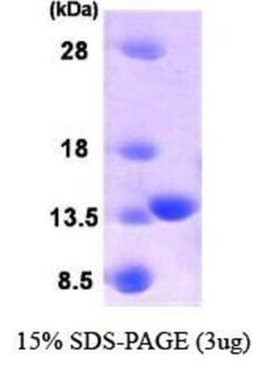Novus Biologicals Recombinant Human PLA2G16/HRASLS3 Protein 0.1mg; Unlabeled | Buy Online | Novus Biologicals&trade; | Fisher Scientific