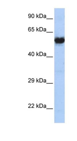 Nicotinic Acetylcholine Receptor gamma Antibody, Novus Biologicals 0.05mg;
