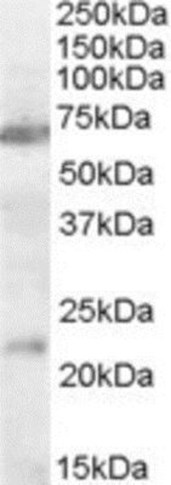 Nicotinic Acetylcholine R alpha 4/CHRNA4 Antibody, Novus Biologicals 0.1mg;