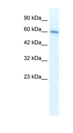 Nicotinic Acetylcholine R alpha 7/CHRNA7 Antibody, Novus Biologicals 100