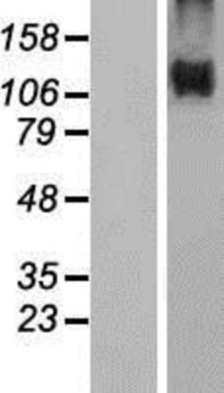 Novus Biologicals&trade;&nbsp;Niemann-Pick type C1 Like-1 Overexpression Lysate