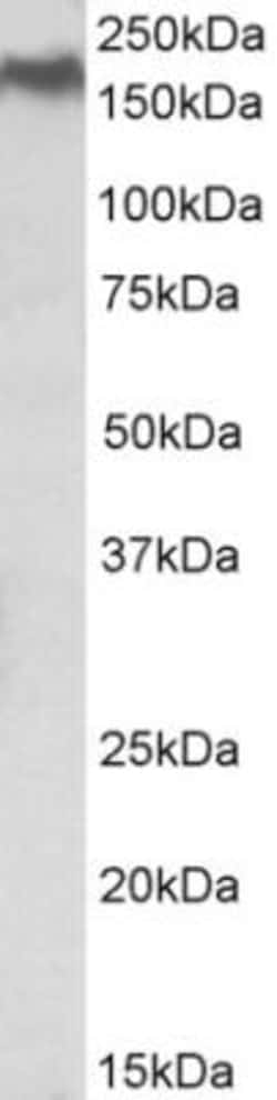 Niemann-Pick C1 Antibody, Novus Biologicals 0.1mg; Unlabeled:Antibodies,