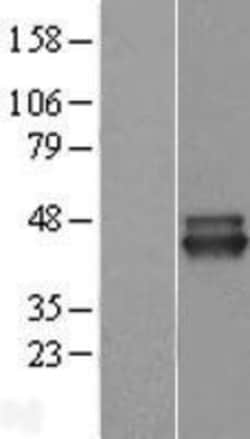 Novus Biologicals&trade;&nbsp;NIF3L1 Overexpression Lysate