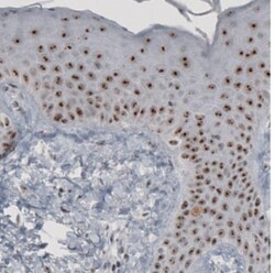 NIFK Antibody (CL2237), Novus Biologicals:Antibodies:Primary Antibodies