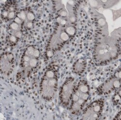 NIFK Antibody (CL2237), Novus Biologicals:Antibodies:Primary Antibodies