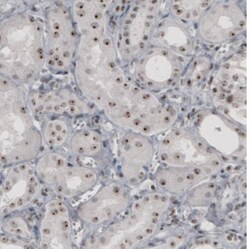 NIFK Antibody (CL2237), Novus Biologicals:Antibodies:Primary Antibodies