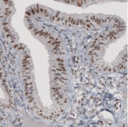 NIFK Antibody (CL2237), Novus Biologicals:Antibodies:Primary Antibodies