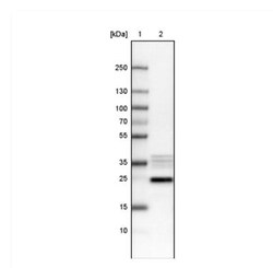 NIFK Antibody (CL2237), Novus Biologicals:Antibodies:Primary Antibodies